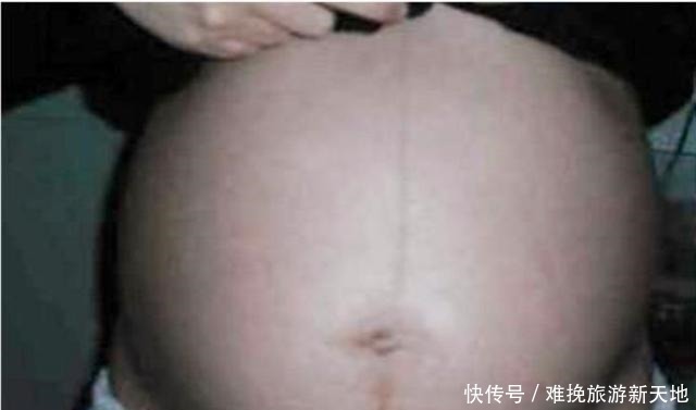 怀疑人生|孕期这些部位黑到“怀疑人生”，孕妈别担心，这是娃发育好的表现