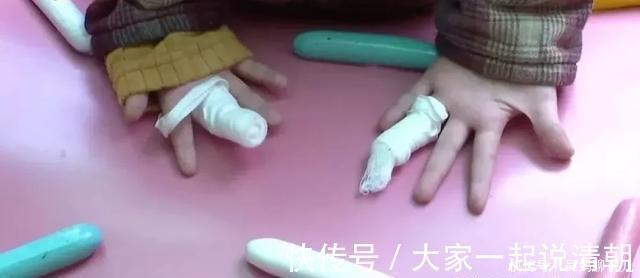 受伤|男孩跟着妈妈去买奶茶被烧伤,却不敢说,背后原因让父母后悔莫及