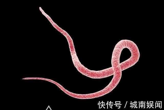 家长|若孩子肚子里有蛔虫,会出现这些“信号”,家长速查你家娃有吗