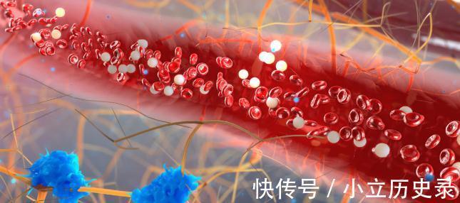 并发症|糖尿病患病多久会出现并发症?各种并发症来临前都会有哪些症状?