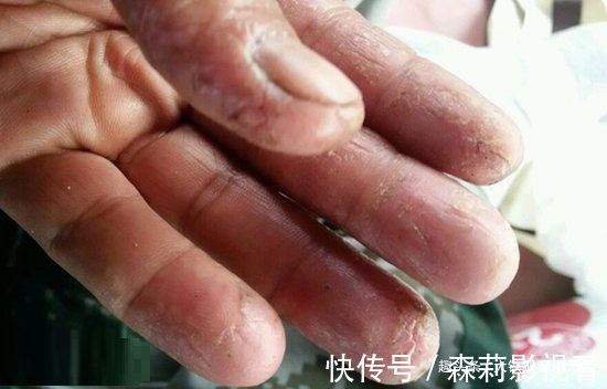 钓鱼|钓鱼人的“悲哀”也许这3种病就是我们的归宿,请不要再耍虎了!