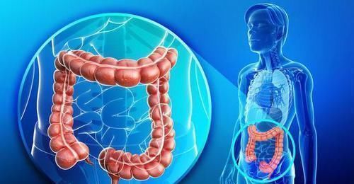 大肠癌|消化科主任提醒:这样的排泄物,可能预示大肠癌细胞已经找上门