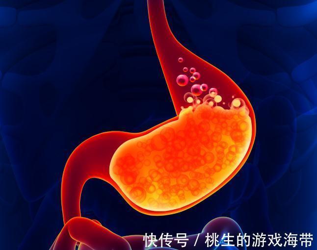 南瓜|胃有“7怕”!医生提醒:多吃“3黄”,做好“3事”,胃越来越好