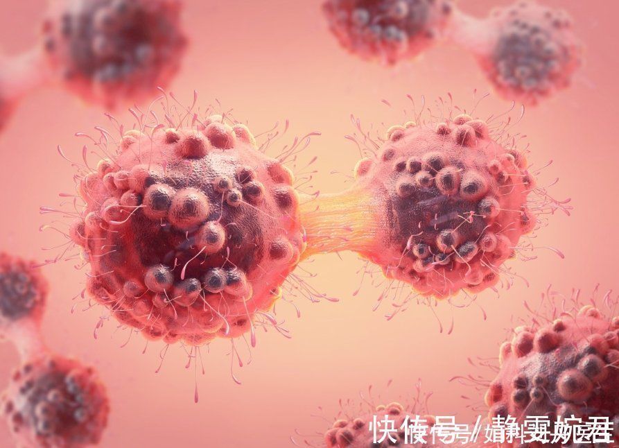 繁殖|癌细胞是如何“杀死”一个人的？它喜欢你做这3件事，别给它机会