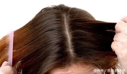 洗发水|如何正确使用洗发水,越这样洗头皮屑越严重!有头皮屑的人都看看