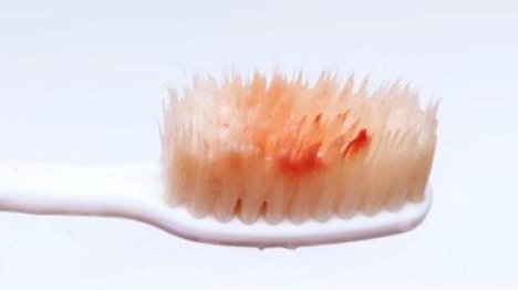 肝脏|28岁幼师查出肝癌，3月后离世，医生惋惜：1汤天天喝，堪比毒药