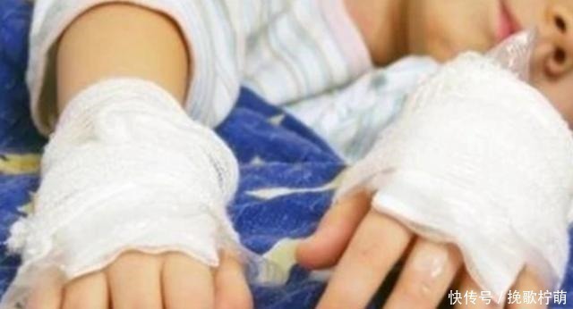 烫伤处|4岁娃被开水烫伤,宝妈“两个果断”救了娃,医生称赞没少读书!