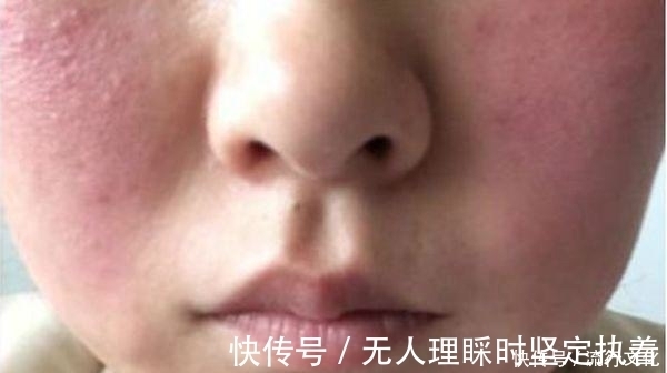 视力|血糖高的人,脸上若没有这4个“变化”, 恭喜你!状态可能还不错