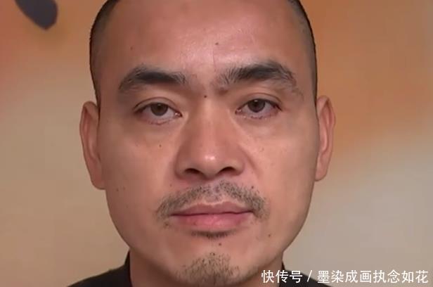 割完眼袋眼睛不对称 男子不敢抬头看人 店方正常人也不对称 快资讯