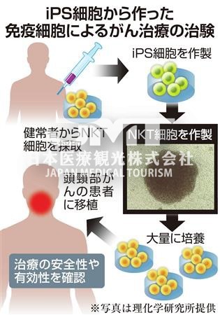 Jmt日本尖端医疗 千叶大学研究团队将ips制作的nkt移植给癌症患者 快资讯