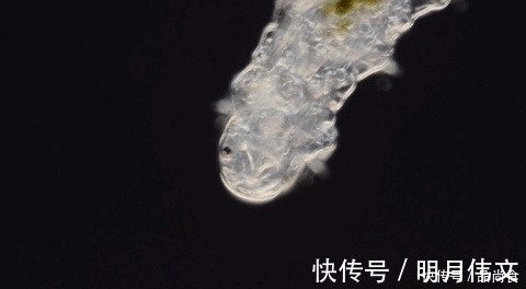 床上螨虫太多?教你3个不要钱的“土法子”, 把螨虫“赶尽杀绝”