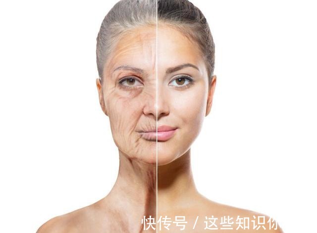 下垂 32岁姑娘小拉皮术后7个半月,变得年轻又精致,前后反差很大!