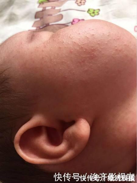 漂亮|怀孕期间想要宝宝白净漂亮,不长胎毒和黄疸,注意以下几点