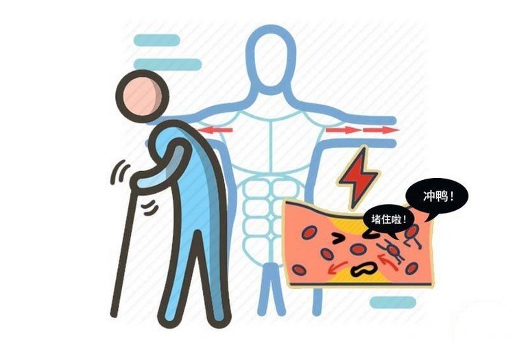 血糖|3种食物是“降糖大王”,糖尿病人多吃,帮助促进代谢、降血糖