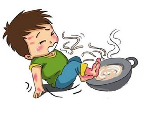 孩子|2岁孩子掉进滚烫开水里致全身50%烧伤,全因奶奶急救方法不对