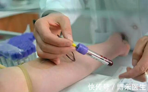 凝血功能|体检抽血伤口肿了淤青有事吗