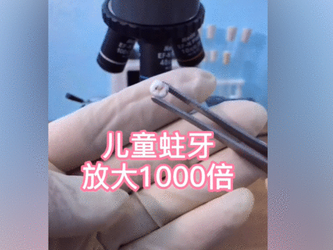 虫子|儿童蛀牙放大1000倍,密密麻麻的虫子太恶心,妈妈咋保护娃的牙齿