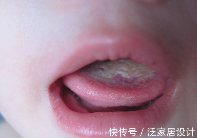 肠胃|5岁女童查出脾虚,医生:3种调料太伤脾,铁打的脾胃也扛不住