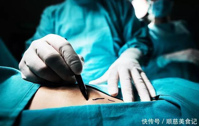 吸脂|泰国网红抽脂整出8块腹肌!告诉你抽脂多危险!带你科学练腹肌