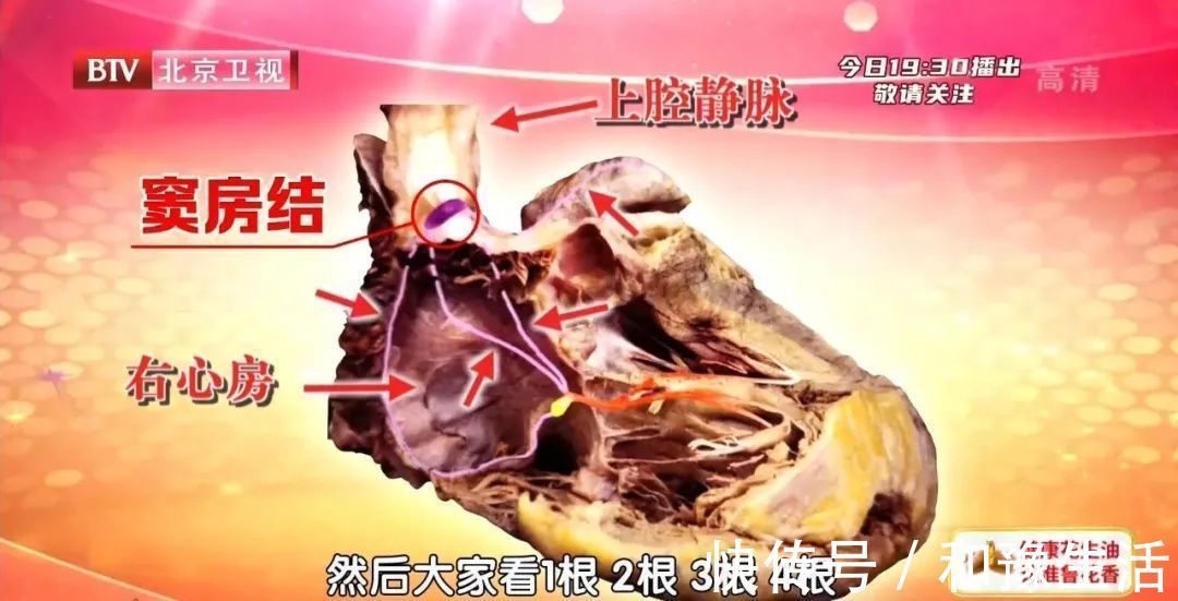 头晕头痛|心跳过慢、过快、乱跳,都是因为它出了问题!一个小方法,提早发现危机~