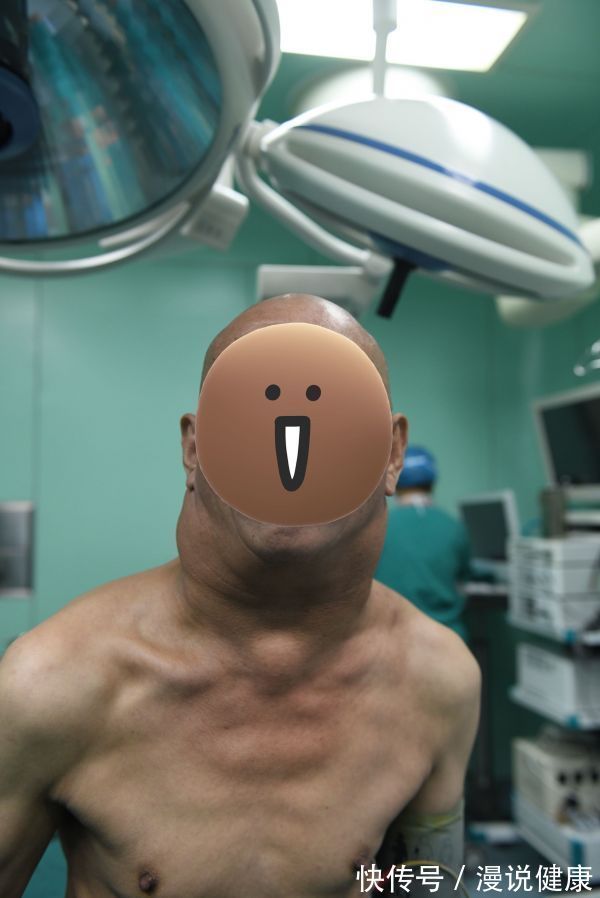 坏习惯|男子喝酒喝出怪病,脖子粗得像河马?喝酒时这4个坏习惯,别做