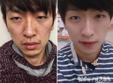 差别|“长期化妆”和“长期素颜”的4大差别!究竟哪个对皮肤好