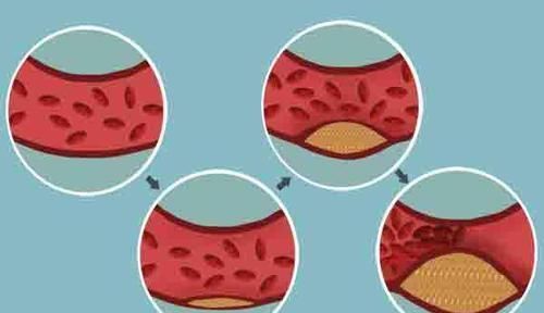 公认的长寿特征,对照自查一下,若全占,寿命不会短