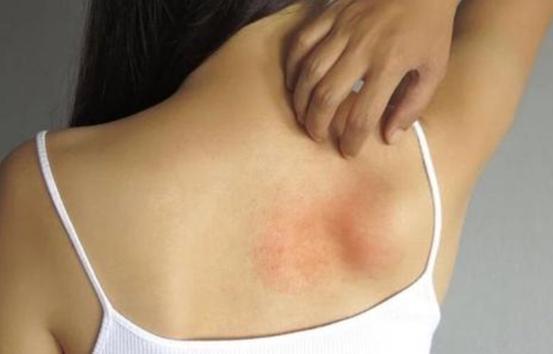 淡化|建议吃逍遥丸能淡化色斑关于逍遥丸的使用,你需要注意!