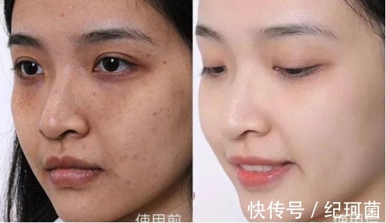 黄褐斑|大牌祛斑产品哪款最有效果？全球公认最好的祛斑产品抢先看~
