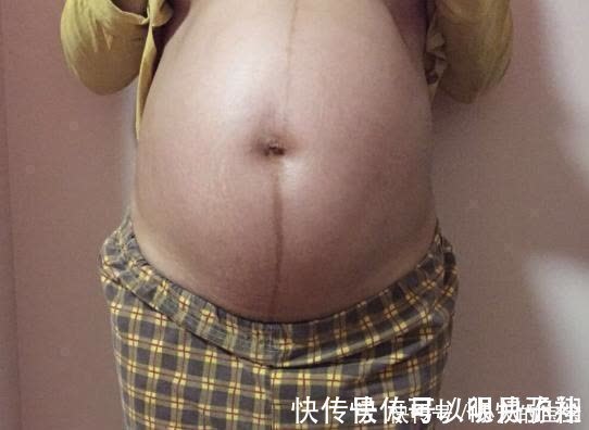 早孕|胎盘低也得过了这时间,早孕别乱定义,不然容易吃亏