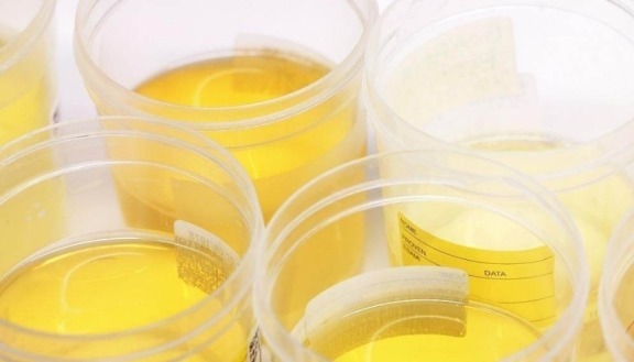 枳椇子|37岁女子腹泻不止，患上肝癌医生提醒：如厕3种异常，尽快查CT