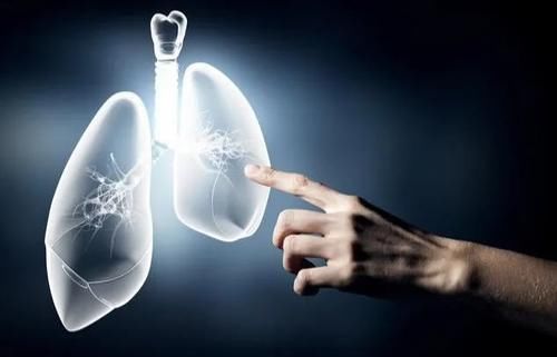 ct|肺部若受损，身体会有3处感到“疼痛”，占一个，最好也查下肺CT