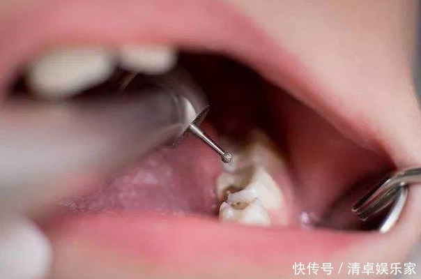 干细胞|孩子退掉的乳牙,父母不要乱扔,关键时刻能救孩子一命!