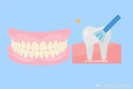 牙周组织|牙结石容易造成牙龈疾病