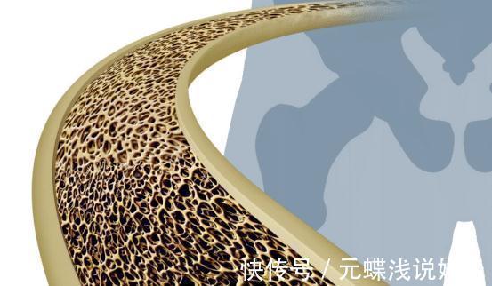骨骼|告诉大家:吃一口等于30袋盐,医生:若你爱吃,骨头越来越脆,尽量少吃