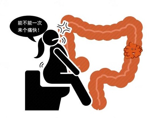 粪便|大便“先硬后软”是大肠癌征兆?医生忠告,4种异常便别掉以轻心