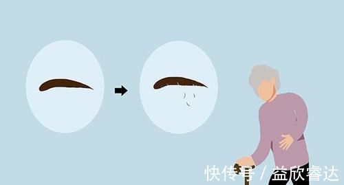 对照|眉毛是健康晴雨表,出现变化,或许是疾病的征兆?对照自查下