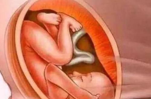 试管婴儿|正常的婴儿和试管婴儿会有什么不同呢？了解一下就清楚了