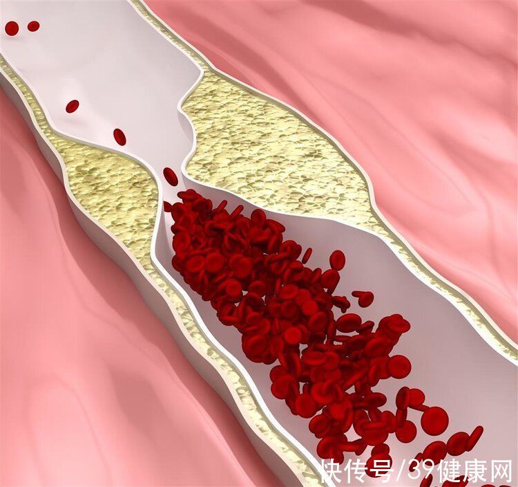 造血干细胞移植|保留脐带血，要还是不要？血液病专家告诉你答案，不用纠结了