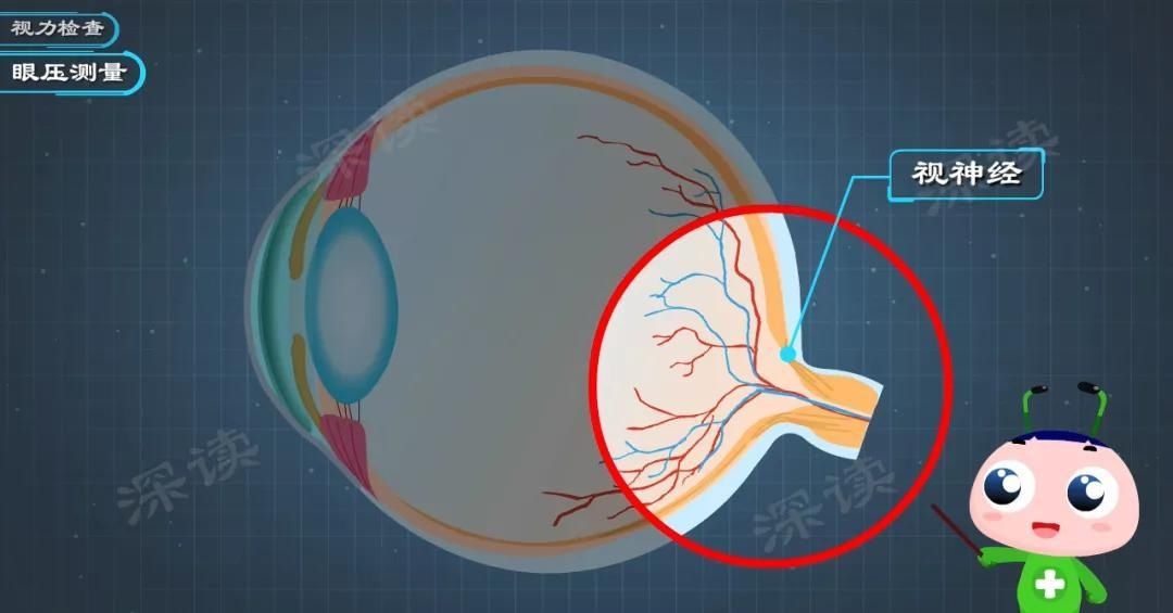深读君|看眼底就能查青光眼？动漫科普青光眼检查黑科技