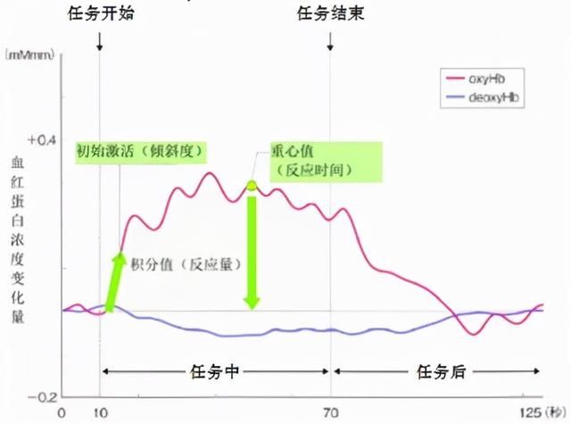 真凶|30岁女子颈痛原来不是颈椎病，瑞金医院医生抽丝剥茧揪出疼痛“真凶”