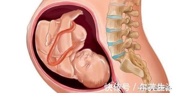 宫口|分娩时,这3种产妇宫口开得快,即使占一个,顺产时会少受很多罪