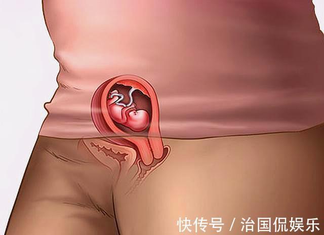 宝宝|怀孕有多辛苦五张图带你看看孕期全过程，孕妈们辛苦了