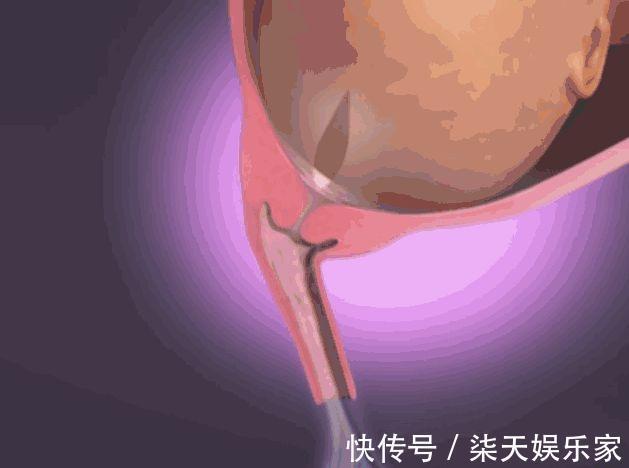 产妇|胎儿出生前都在忙什么组图播放全过程,着急见爸妈的样子真可爱