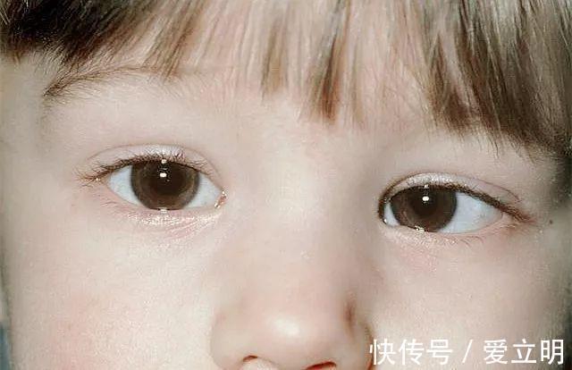 宝妈|宝宝视力发展全过程,你家达标了吗?(必看)