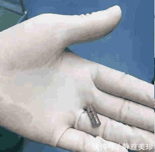 医科大学|1岁半宝宝突然倒地身亡, 医生竟在体内找到此物, 家长注意了