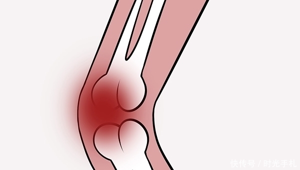时间段|吃钙片补钙有用吗?哪个时间段吃,效果最好?骨科医生给出了答案