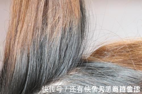 染发剂 头发变白爱染发,虽减龄、显年轻,但是可能会引发皮肤疾病