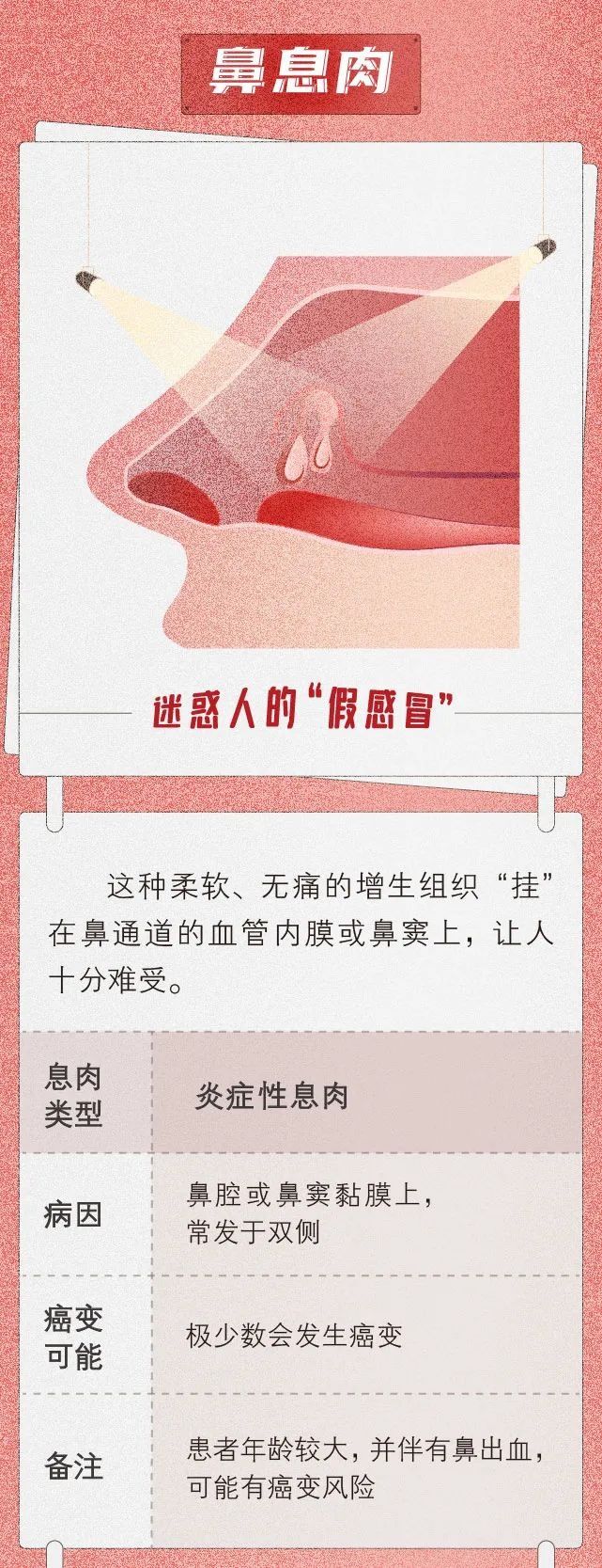 隐患|“小息肉”如何成为“大隐患”？不可忽视，该出手时就出手！