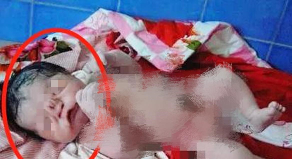 畸形|高龄产妇生下“猪八戒”宝宝,丈夫不想抚养,医生的解释挽救了娃